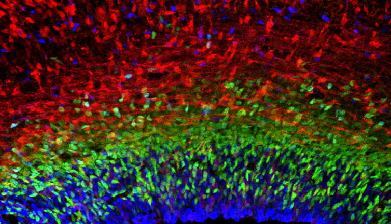 Cerebral cortex June2021 Arlotta web 768x440